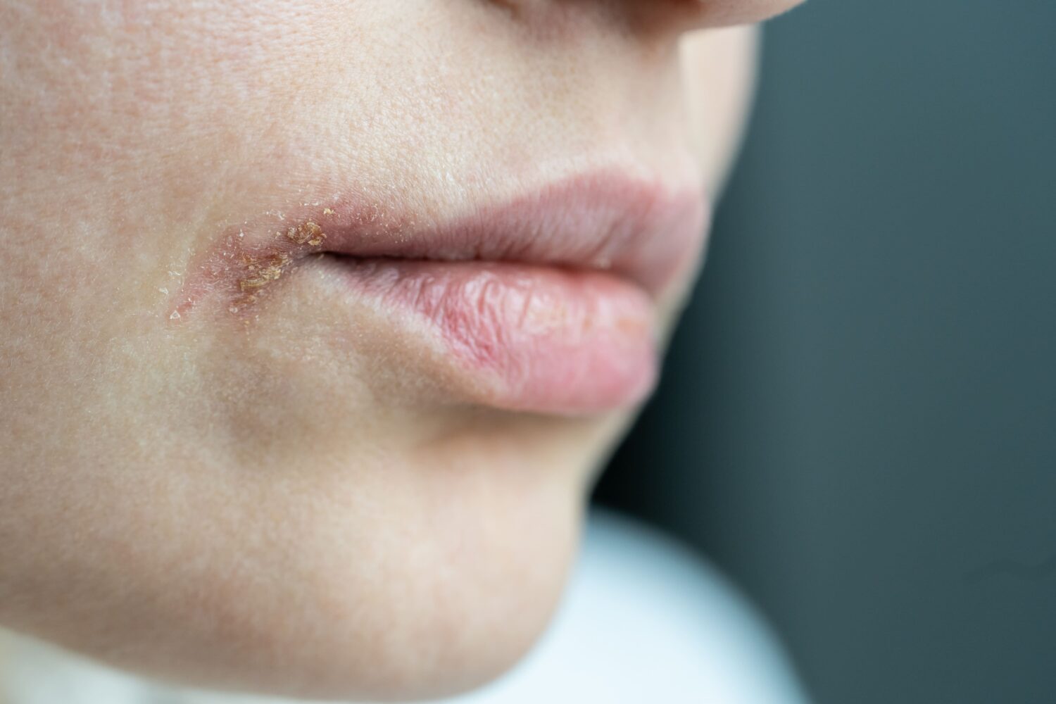 10 Tips Memakai Lipstik agar Bibir Nggak Pecah-Pecah