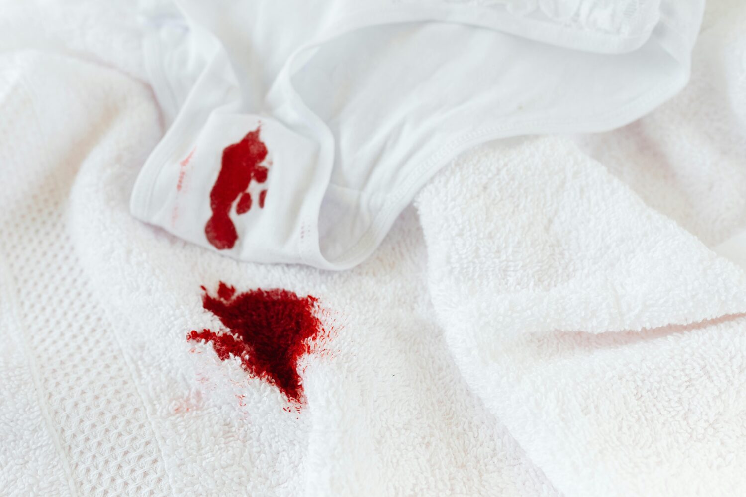 Tips Mengatasi Menstruasi Berat