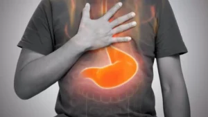 10 Gejala GERD yang Sering Dianggap Sepele tapi Ternyata Berbahaya