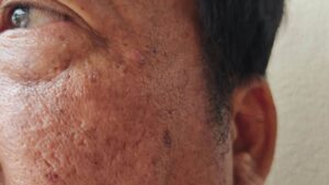 9 Bahan Dapur yang Ampuh Bantu Samarin Flek Hitam