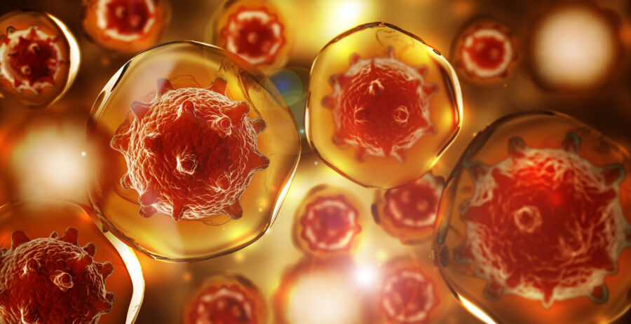 10 Perbedaan tumor dan kanker