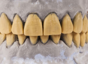 10 Kebiasaan Sepele yang Bikin Gigi Kuning 