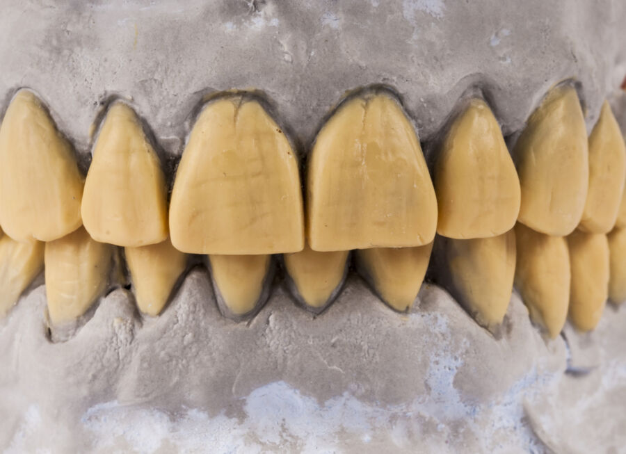 10 Kebiasaan Sepele yang Bikin Gigi Kuning 